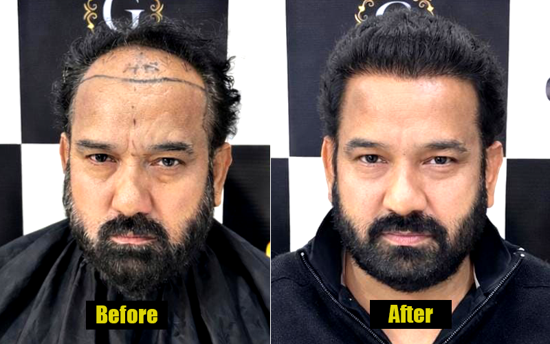Patient Result 1