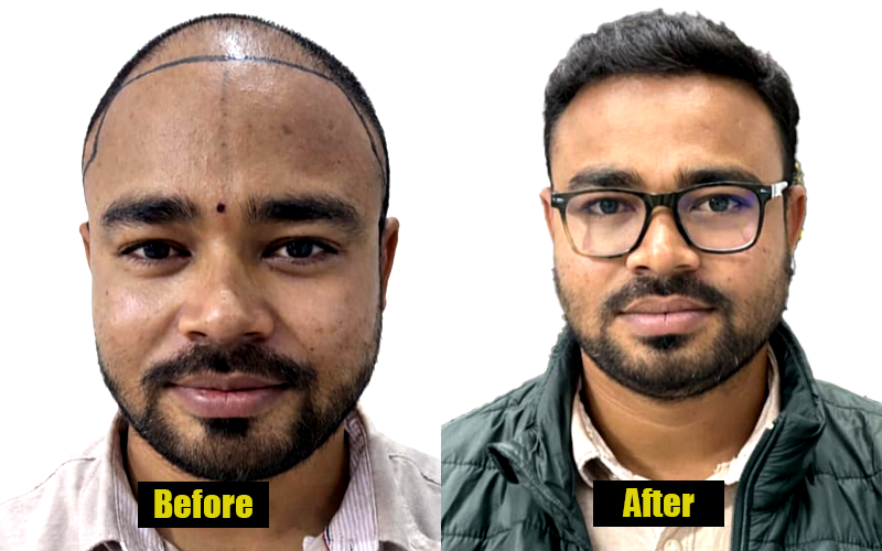 Patient Result 2