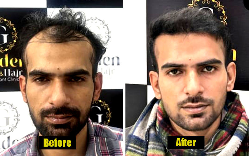 Patient Result 5