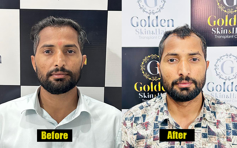 Patient Result 6